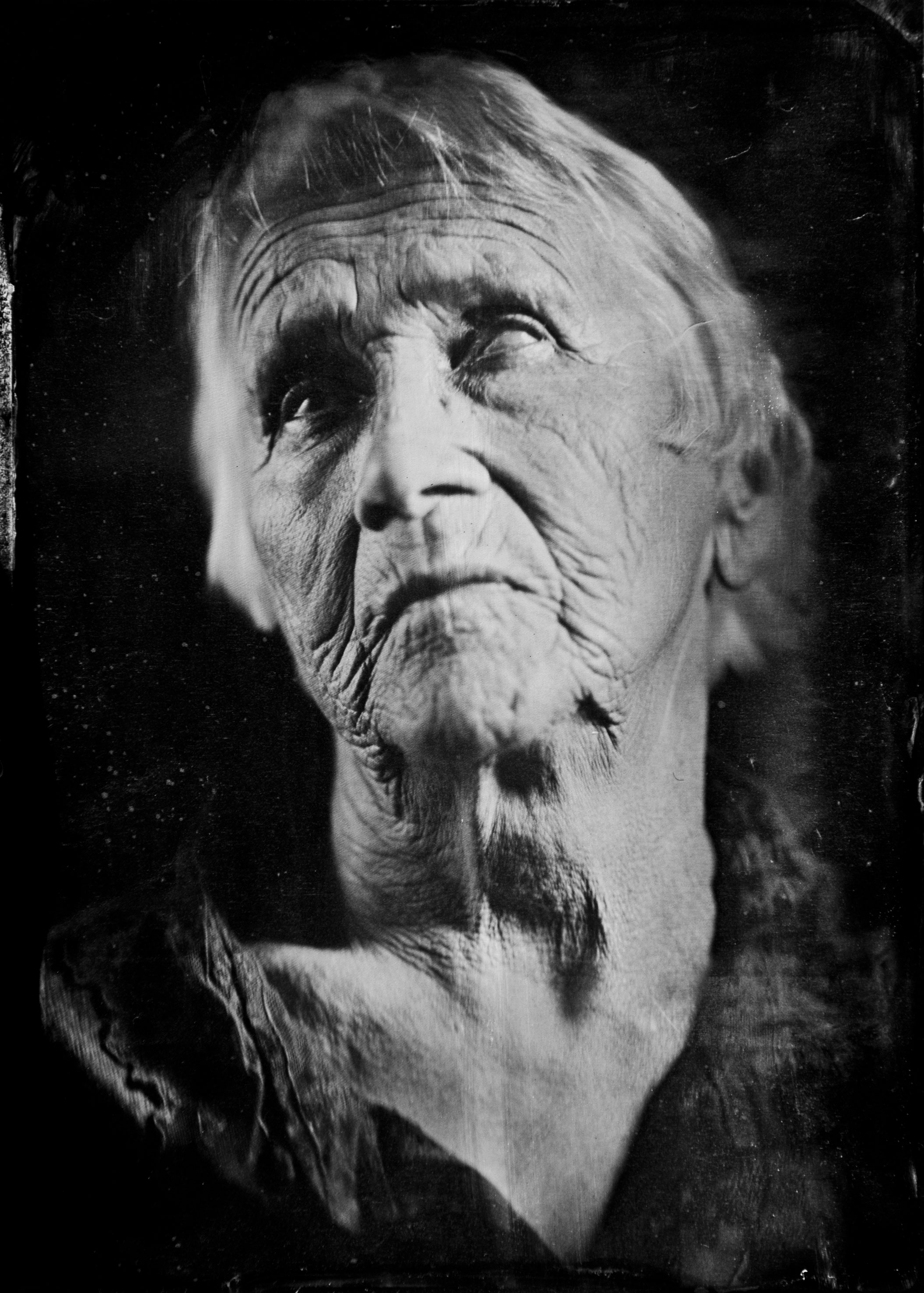 Collodion