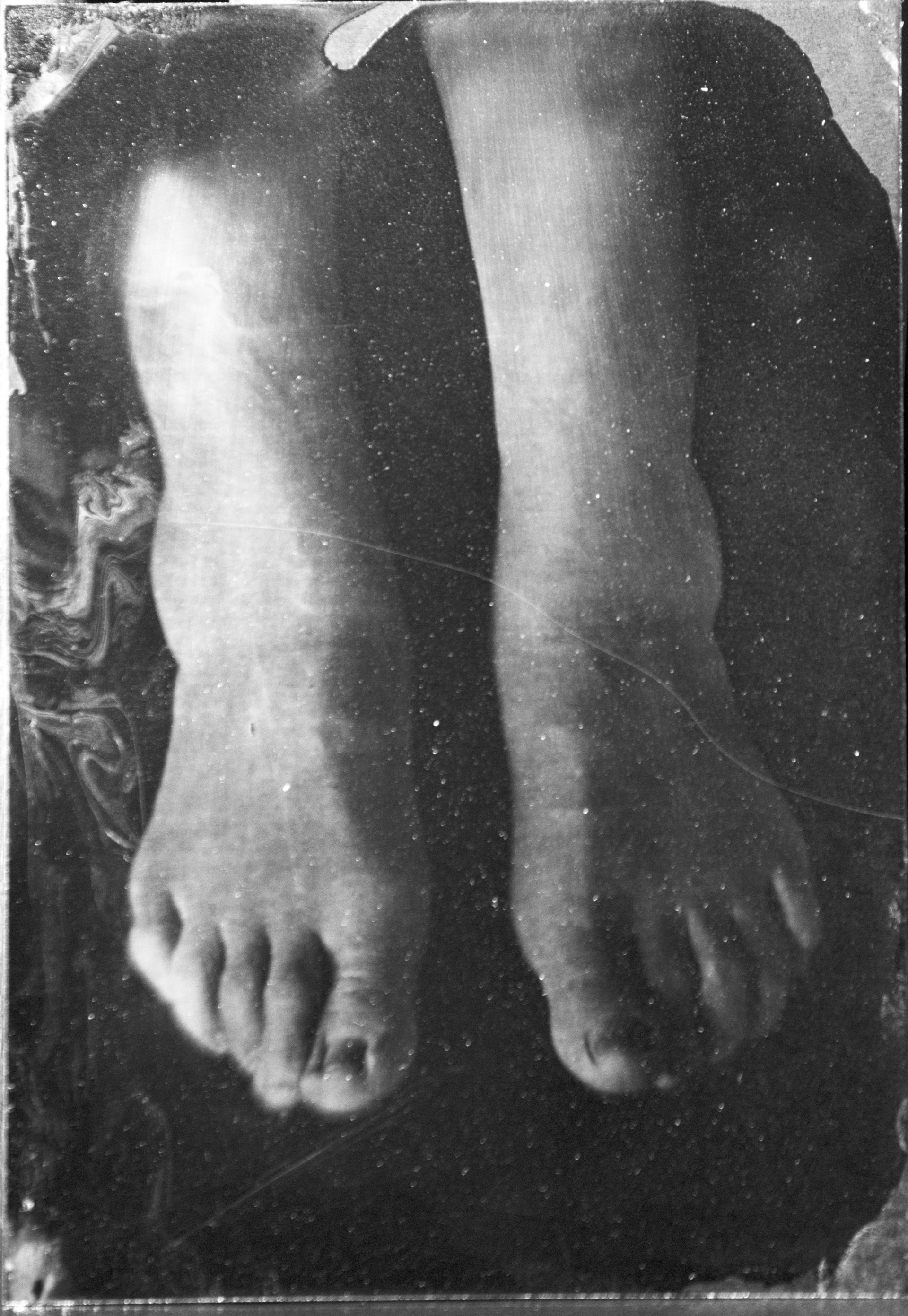 Collodion